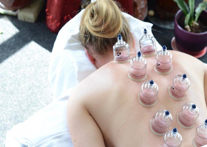 Cupping at Glamis